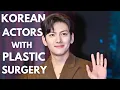 Lagu Top 10 Korean Actors With Plastic Surgery in 2024