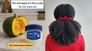 Alopecia Gone Just Like That .Use This Everyday For Thicker Hair Growth.