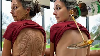 AOS 62 ANOS PAREI O ENVELHECIMENTO Isso TIROU as RUGAS sem PLASTICA E MANCHAS sem Ácido. 