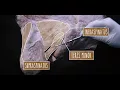 Neuroanatomy S3 E2: The Upper Limb #neuroanatomy #ubcmedicine