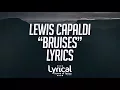 Lewis Capaldi - Bruises