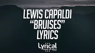 Lewis Capaldi - Bruises