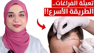 أسرع طريقة لإنبات الشعر في مقدمة الرأس حل مشكلة الجبهة العريضة و الشعر الخفيف بديل جلسات العيادات 