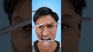 Surviving A Rod Through The Head 😲