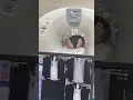 Download Lagu CT Scan | NCCT Whole abdomen | Mbbs intern duty | Radiodiagnosis #krishna #xray #ctscan #mbbs #neet