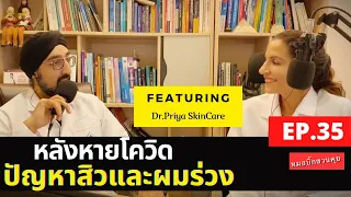 สิวที่เกิดจากสเตอรอยด์หายเองได้ไหม และใช้เวลานานแค่ไหน