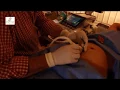 What is CVS Chorionic villus sampling