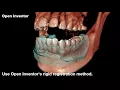 Open Inventor Toolkit Multimodality Rigid Registration 3D Visualization Toolkit