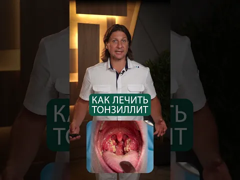 Вы лечите тонзиллит НЕПРАВИЛЬНО! Проверьте себя! #здоровье #тонзиллит #горло