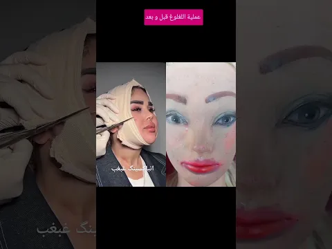 قبل و بعد عملية اللغلوغ #مكياج_سينمائي #makeupartist #تجميل #makeup