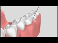 Quicksleeper5 The three-step process animation