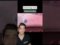 Wound healing - let us take a look at how your body heals after you are cut