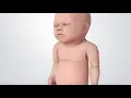 Infant Distress Warning Signs Grunting Baby Sound