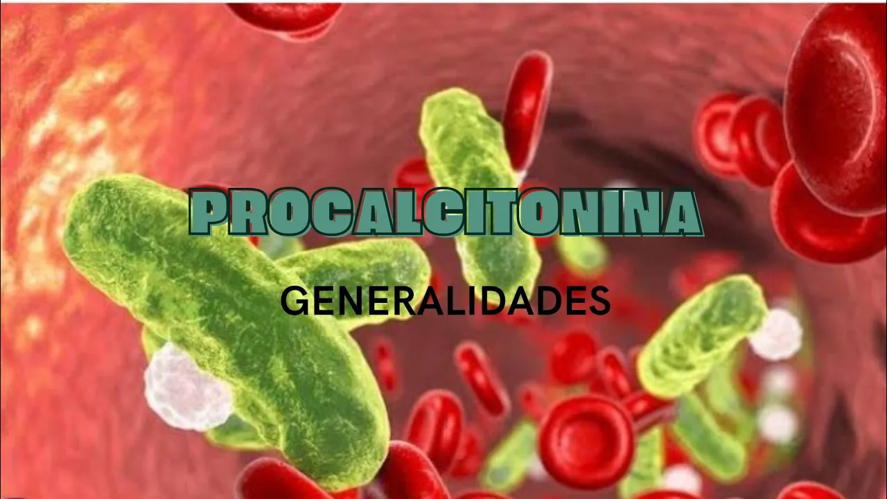 PROCALCITONINA GENERALIDADES