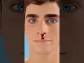 Download Lagu If Your Nose Starts To Bleed