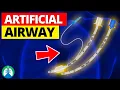 Artificial Airway Medical Definition Quick Explainer