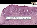 Intro to Dermpath Common Structures Terms in Dermpath