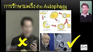 การอดอาหารเพื่อรักษาโรคมะเร็งต้องระวังอะไรบ้าง?