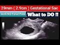29mm Gestational Sac with NO Fetal Pole - is This Final Diagnosis of Missed Miscarriage