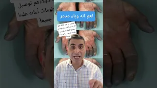 نعم إنه وباء مدمر #دكتوروليدشوقى