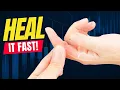 Download Lagu How To Treat A Jammed Finger
