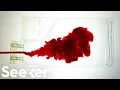 Download Lagu What Really Happens to Your Blood After You Donate?