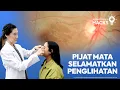 Download Lagu Tangani Emergensi Mata dengan Pijatan