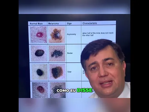 Quando realizar a biópsia do linfonodo sentinela #shorts
