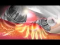 VelaShape in Bountiful Utah