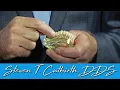 What is a Dental Implant - Dental Minute with Steven T Cutbirth DDS