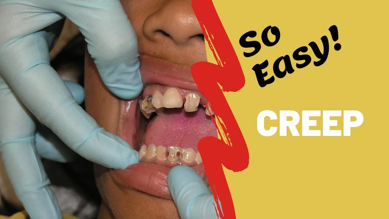 Creep | Physical properties of dental materials |