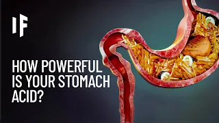 Download What If Your Stomach Acid Disappeared MP3