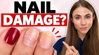 Are Gel Manicures Damaging Your Nails? A Dermatologist Explains