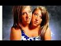 Co joined twins Abby and Brittany finally marries Josh Bowling