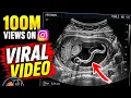 Stomach Scan for Kids What Happens If You Eat Too Much Chocolate Ultrasound Kids Doctor Scanner