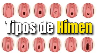 أنواع غشاء البكارة التفسيرات الطبية والفضول فهم جسمك بشكل أفضل 