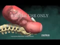 Normal Vaginal Birth with Cervical Effacement and Dilatation Dilation