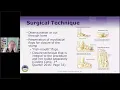 HCGTV Webinar Snippet - Amputation Coding for PCS
