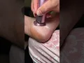 Spa-Quality Foot Care at Home Dermave Electric Callus Remover