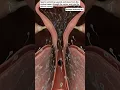 Lagu Sperm swimming upward and down from the vaginal canal, through the cervix|human anatomy art