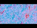 Hector Gachan - Really Something