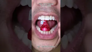 The Most Satisfying Chocolate & Candy ASMR Compilation