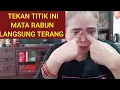 Download Lagu Cara mengatasi mata buram(rabun)