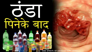 Side effects of drinking soft drinks || What happens if we drink cold drinks daily ?