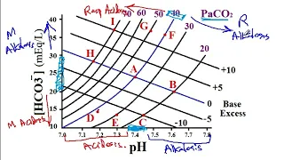 USMLE ACE 240 Acid-Base Disorders Diagnosis and Anion Gap Analysis