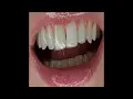 Valerie Ace - Glucose Guardian [SKIN005]