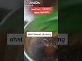 MANFAAT REBUSAN DAUN KENIKIR BAGI KESEHATAN 👆🏻