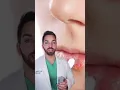 COLD SORES ON THE LIPS