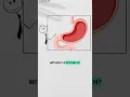 Download Lagu Surviving Without A Stomach #gastrectomy