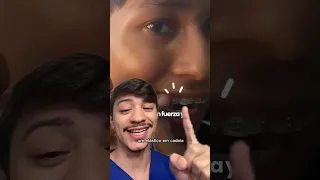 Ele botou Aparelho dental Caseiro mas ele esqueceu de uma coisa